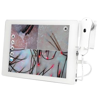 SHENGSHIYU Professional 15-Inch Scalp Analysis Camera, 32 GB, Dual Lens, 200X HD, Multispectrum
