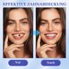 4 Pairs Clip-On Veneers with 8 Dental Fitting Gel Tubes and 4 Tools view 2