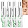 Turmeric Retinol Eye Balm Stick for Dark Circles, Puffiness & Fine Lines, Hydrating Anti-Aging Cream (8 pcs) view 1