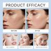 Amino Acid Acne Foaming Cleanser, Gentle Moisturizing Facial Cleanser, Oil Control, 100 g (2-Pack) view 3