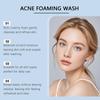 Amino Acid Acne Foaming Cleanser, Gentle Moisturizing Facial Cleanser, Oil Control, 100 g (2-Pack) view 4