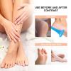 DECHOUS Handheld Foot Skin Remover, 2-Piece Set, ABS view 3