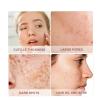 Abaodam Facial Cleansing Brush with Handle view 3