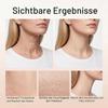 Magic Collagen Fullerene Neck Cream, Anti-Wrinkle Neck Cream with Collagen Peptides, 2-Pack view 4