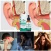 Generic Itch Relief Ear Drops - 30 ml view 4